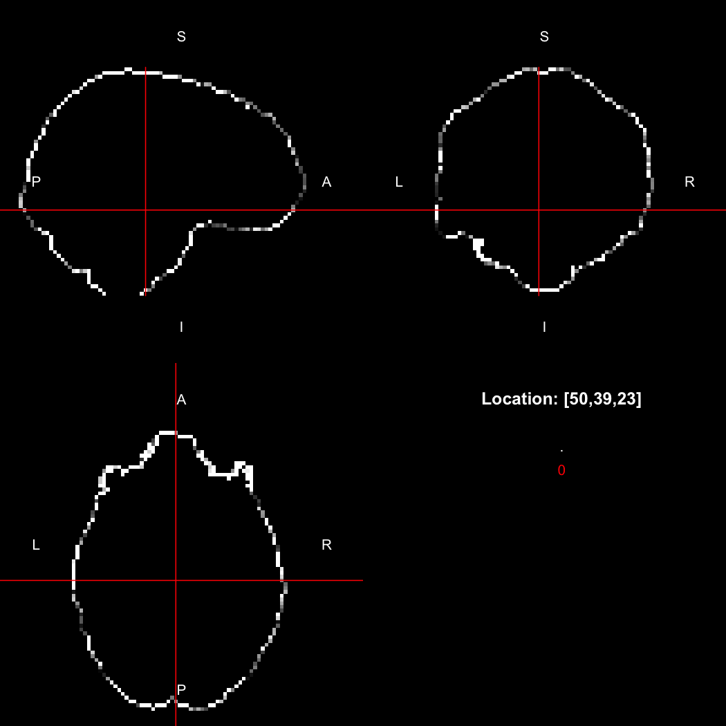 plot of chunk dilate